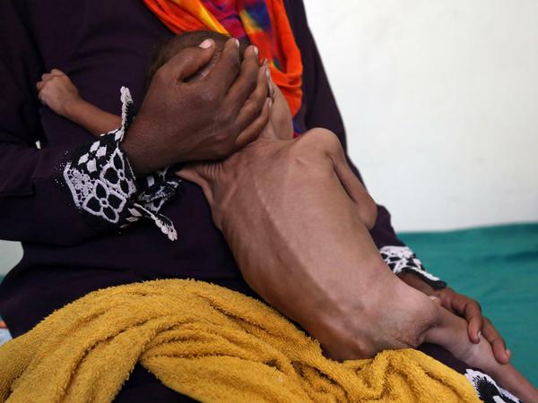 Millionen Jemeniten leiden unter dem Krieg - und Hunger.
