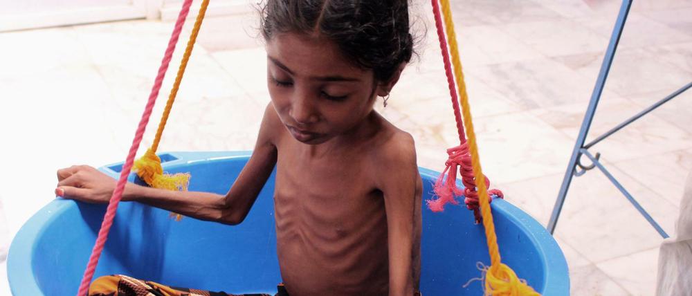 Vom Leben schwer gezeichnet. Save the Children zufolge sind fast zwei Millionen jemenitische Kinder mangelernährt.
