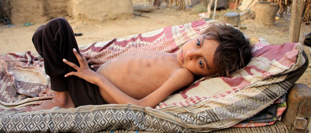 Immer mehr Menschen im Jemen - wie hier in der Provinz Hajjah - leiden an Unterernährung.
