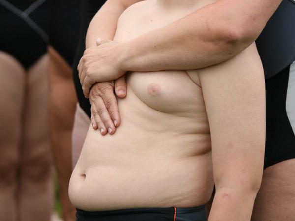 Gefährlich: Wenn Kinder zu dick sind, steigt das Risiko für Diabetes und Herz-Kreislauf-Krankheiten. 