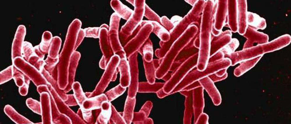 Bakterien der Art Mycobacterium tuberculosis rufen bei Menschen Tuberkulose hervor.