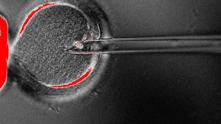 Heikel. Mit einer Pipette wird vorsichtig der Zellkern mit dem Erbgut der Mutter aus dem unbefruchteten Ei entfernt. Dabei können auch einige kranke Mitochondrien angesaugt werden.