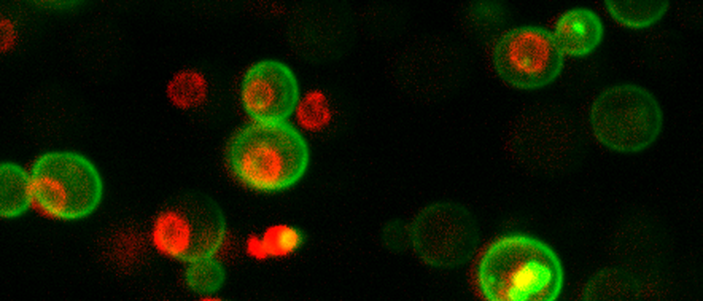 Hefezellen enthalten etwa 42 Millionen Proteinmoleküle.