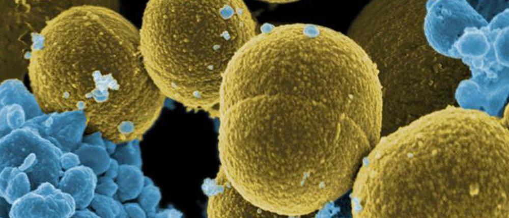 Staphylococcus aureus (gelb) ist ein Bakterium, das etwa auf der menschlichen Haut vorkommt. Einige Stämme sind gegen Antibiotika resistent geworden. Immunzellen (blau) können sie aber noch bekämpfen. Elektronenmikroskopische Aufnahme, angefärbt.