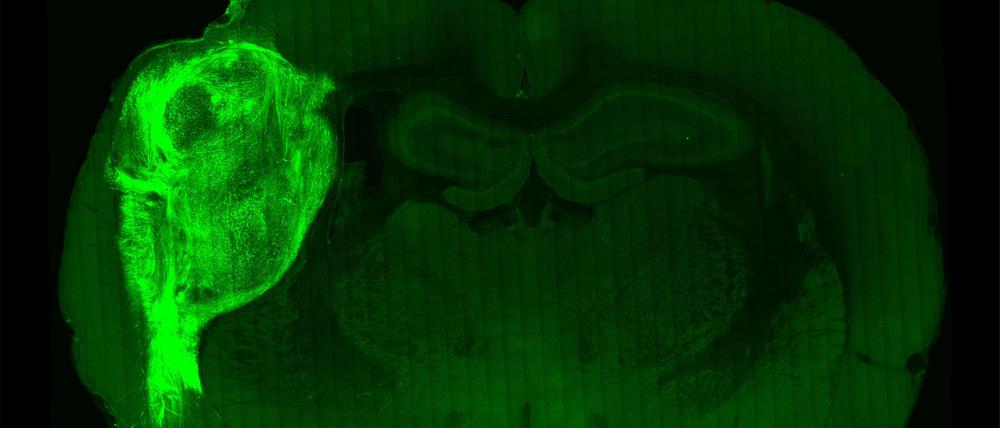 Menschliches Organoid (fluoreszierend) in Schnitt von Rattenhirn.