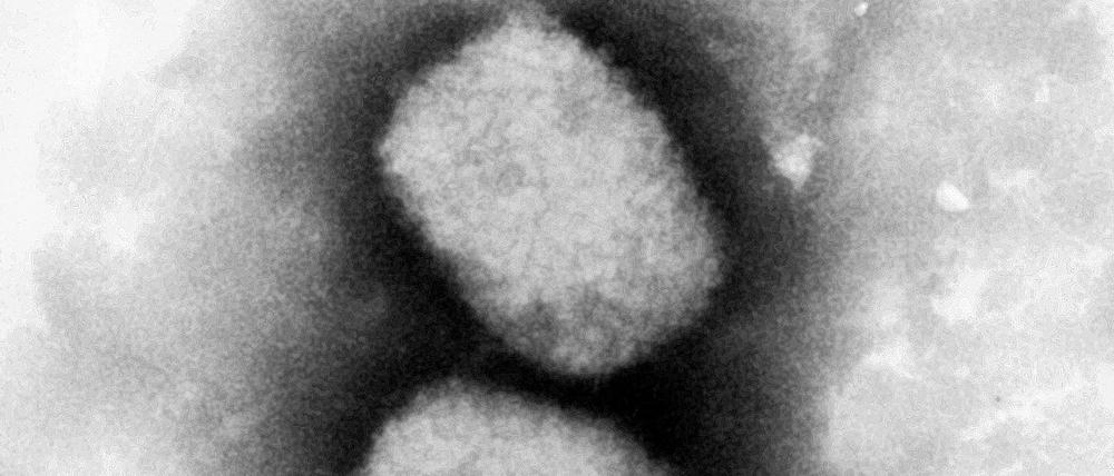 Diese vom Robert Koch-Institut (RKI) zur Verfügung gestellte elektronenmikroskopische Aufnahme zeigt das Affenpockenvirus. Affenpocken werden wahrscheinlich vor allem von Nagetieren, nicht Primaten, auf Menschen übertragen. Menschen können sich aber auch untereinander anstecken. 