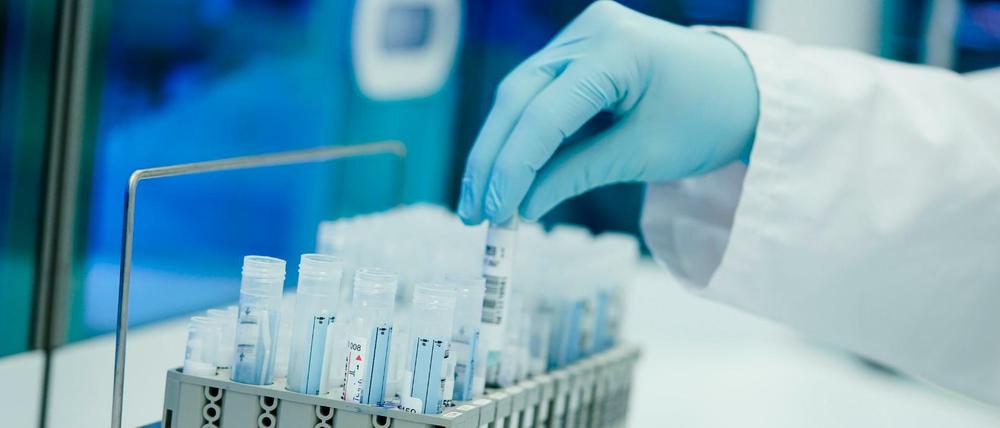 Ein Mitarbeiter wertet in einem Labor mehrere PCR-Tests aus.