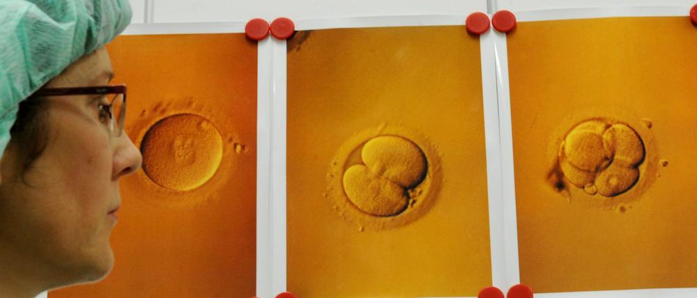 In der Universitätsfrauenklinik in Leipzig hängen Abbildungen von Eizellen mit Spermien nach einer künstlichen Befruchtung. 