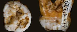 Vom Denisova-Menschen gibt es bislang nur ein paar wenige Knochenreste aus einer Höhle im sibirischen Altai-Gebirge, darunter auch Zähne, aus denen Erbgutreste isoliert werden konnten. 