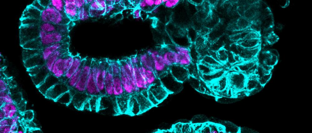 Aus Stammzelllinien (hier von der Maus) können Forscher Gebilde formen, die sich schon fast wie normale Embryonen verhalten und entwickeln.