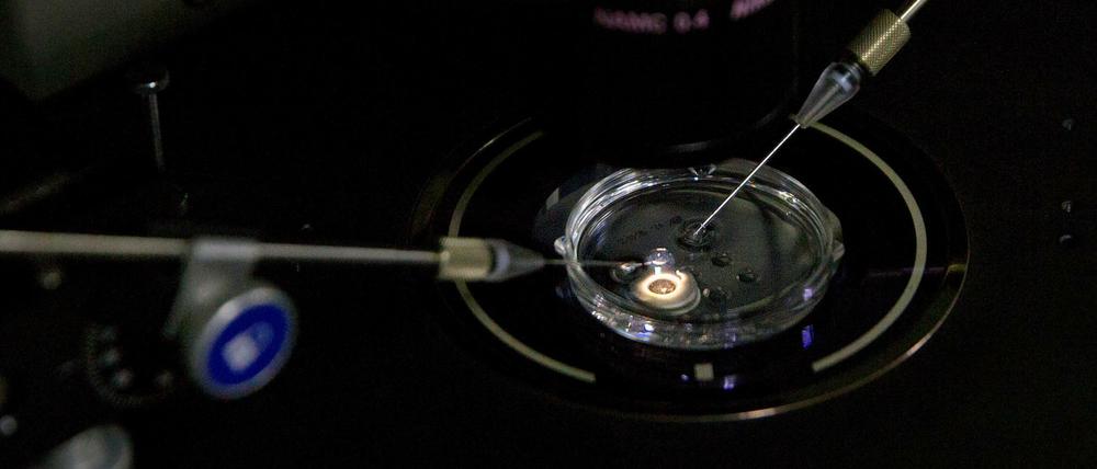 Ein Embryo erhält eine kleine Dosis Cas9-Protein und PCSK9 sgRNA in einem Spermieninjektionsmikroskop in einem Labor in Shenzhen. 