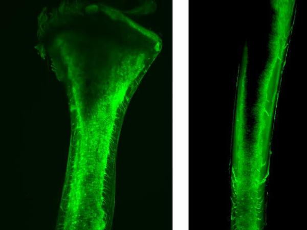 Mittels Lichtblattmikroskopie, kombiniert mit einer grünen Blutgefäßfärbung, konnten die Forscher die Blutgefäße im Röhrenknochen in 3D untersuchen. Die kleinen Gefäße in der Außenschicht des Knochens im linken Bild sind die neu gefundenen TCVs.