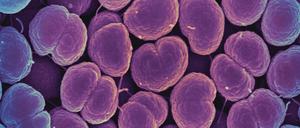 Neisseria-gonorrhoeae-Bakterien verursachen die Gonorrhö, die umgangssprachlich auch als Tripper bezeichnet wird.