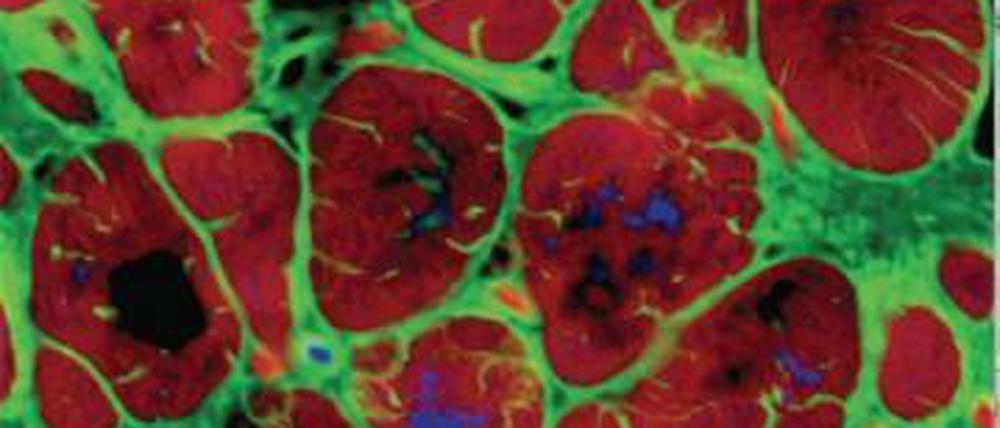 Bestimmte Zellen aus der Plazenta können sich in Herzmuskelzellen verwandeln und beschädigte Regionen von Herzen nach einem Infarkt reparieren - zumindest bei Mäusen. 