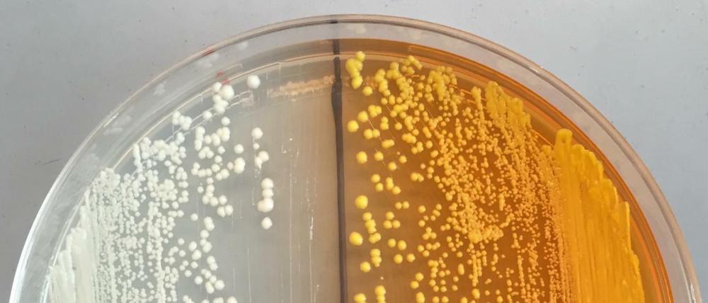 Neue, gentechnisch veränderte Hefezellen produzieren Vorläufer für Opiate (gelb gefärbt). Das kann die Herstellung von Arzneimitteln wie Morphin oder Antibiotika erleichtertn, eröffnet jedoch auch neue Möglichkeiten für die Herstellung illegaler Drogen.