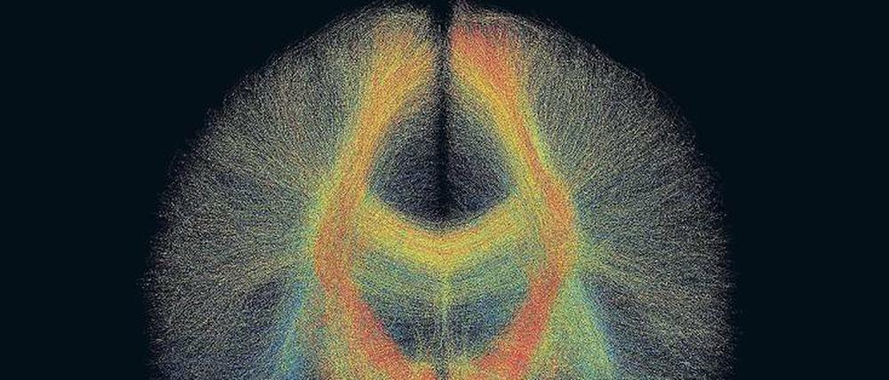Dem Gehirn kann man nur begrenzt beim Arbeiten zusehen. Forschende nutzen Darstellungen wie diese, um die Therapie für Parkinson zu verbessern. 