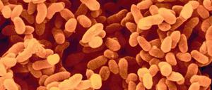 Keimende Gefahr. Bakterien wie diese Kolonie Klebsiella pneumoniae sind immer häufiger gegen fast alle Antibiotika resistent. 