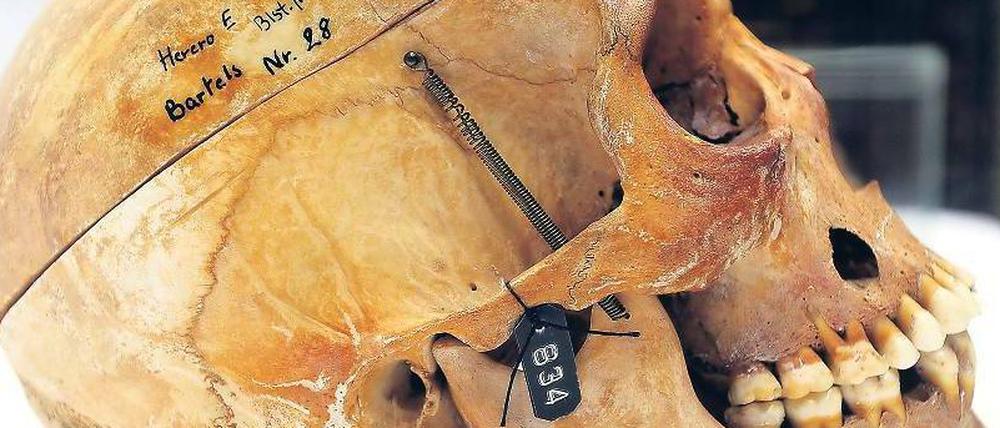 Vor der Übergabe. Der Schädel eines Herero aus der Charité-Sammlung. 20 Stück wurden nun zurückgegeben - mehr als 100 Jahre nach ihrem Tod.