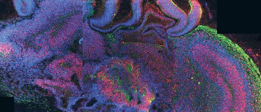 Halbes Hirn. Das Mikroskopbild zeigt einen Anschnitt der Gehirnknospe. Daran lässt sich die Entstehung einzelner Hirnregionen erkennen. 