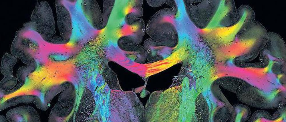 Licht ins Dunkel. Forscher durchleuchten hauchdünne Scheiben des menschlichen Gehirns mit polarisiertem Licht. So können sie erkennen, in welche Richtung Nervenfasern verlaufen und diese unterschiedlich färben. 