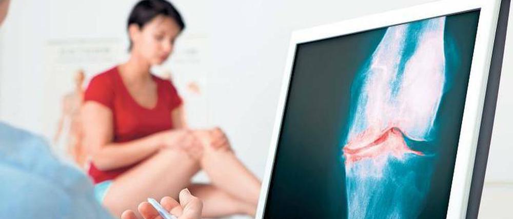 Sichtbarer Schmerz. Anhand von Röntgenaufnahmen können Mediziner die Krankheit diagnostizieren. 