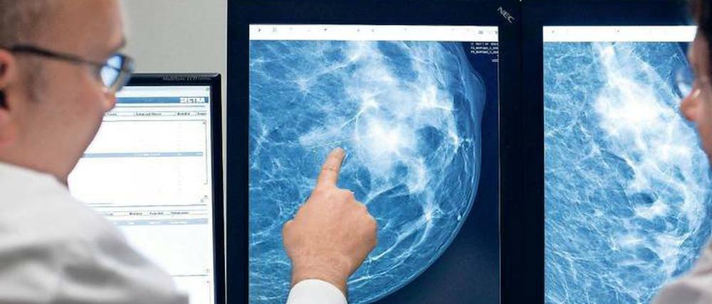 Suche nach dem Krebs. Moderne Mammographie-Geräte machen hochgenaue Aufnahmen. Damit entdeckt man mehr, was wiederum die Entscheidung über das Risiko schwieriger macht.