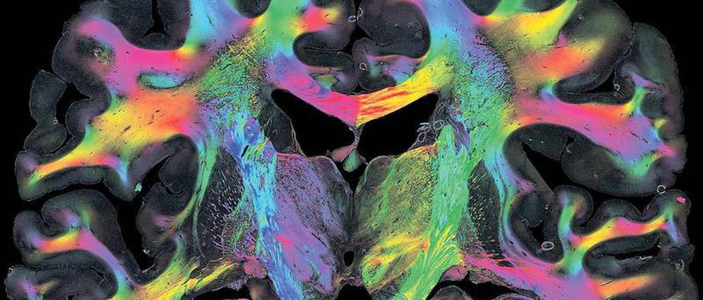 Licht ins Dunkel. Forscher können hauchdünne Scheiben des menschlichen Gehirns mit polarisiertem Licht durchleuchten und so erkennen, in welche Richtung Nervenfasern verlaufen. Auch dabei entstehen Datenberge.