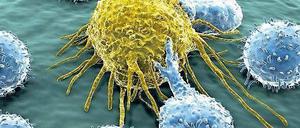 Die Crispr-Genschere kann Immunzellen (blau) so verändern, dass sie Krebszellen (gelb) besser angreifen können. 