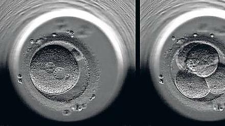 Strafsache Embryo. Es ist nur ein kleiner Schritt für einen menschlichen Embryo vom Vorkernstadium (links), in dem das Erbgut der Eltern noch getrennt ist, bis zum vierzelligen Embryo (Mitte), rund 20 Stunden später. Doch für Reproduktionsmediziner ist es ein großer Unterschied, der über die Legalität einer Embryonenspende entscheidet. 