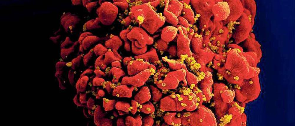Eine von Immunschwächeviren (senffarben) infizierte T-Zelle (rot). 
