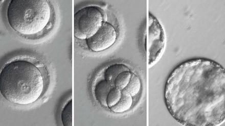 Genetisch verändert. Die Fotos zeigen die Entwicklung von menschlichen Embryonen, deren Erbgut mit der Genschere Crispr/Cas9 korrigiert wurde.