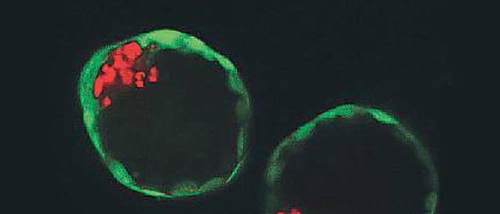 Blastoide - künstlich gezüchtete Blastozysten - ähneln ein Stück weit echten Embryonen. 