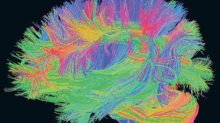 Zum Lernen gehört Vergessen. Dabei werden viele Nervenzellverbindungen im menschlichen Hirn neu gebildet und gelöst.  