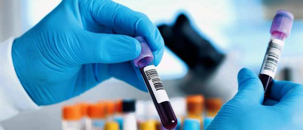 Im Blut der Probanden suchten die Forscher nach Biomarkern.