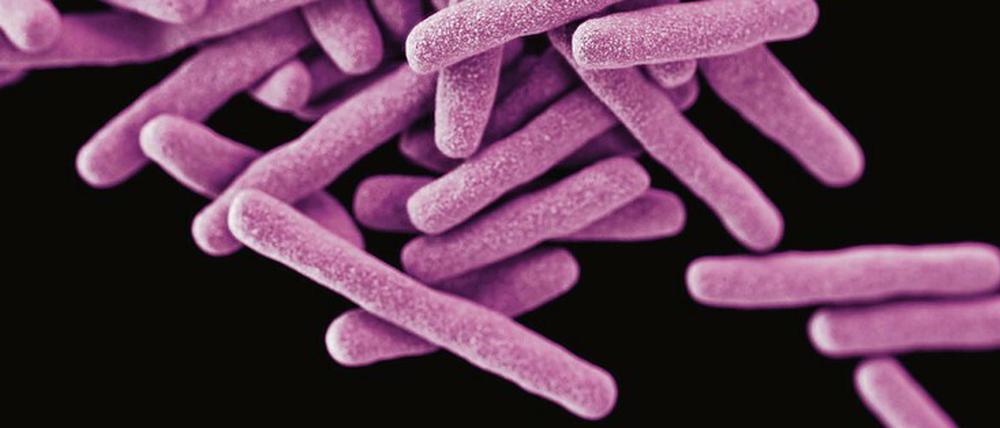 Global Player. 3D-Bild eines Clusters von Mycobacterium tuberculosis. Der Erreger begleitet uns seit Tausenden von Jahren. Auch er mutiert. In jüngster Zeit tut er dies vor allem in einer Weise, die es zunehmend erschwert, seiner mit Antibiotika Herr zu werden. 