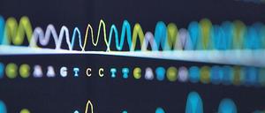 ATGC. Aus diesen vier „Buchstaben“ besteht der Code des menschlichen Genoms.