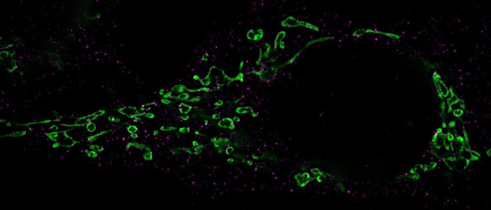Die für die Zerstückelung von Mitochondrien (grün) verantwortlichen Moleküle sind mit Antikörpern markiert und pink angefärbt.