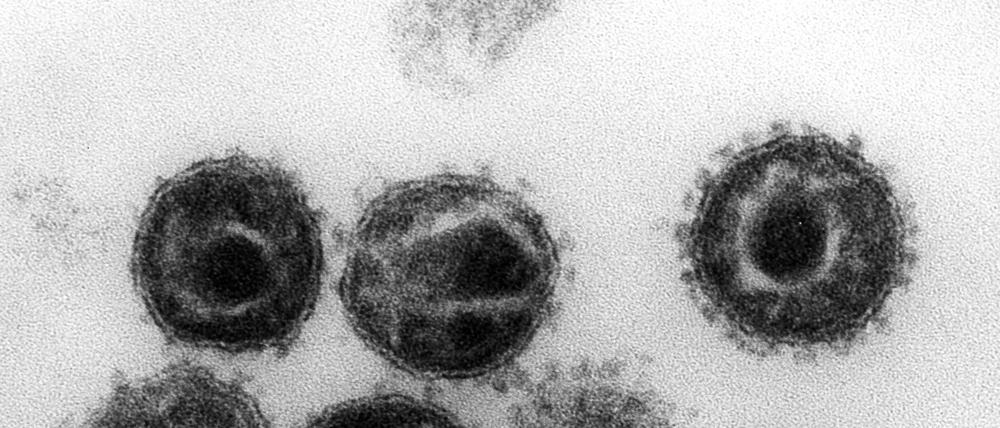 Eine elektronenmikroskopische Aufnahme zeigt mehrere Humane Immunschwäche-Viren (HIV).