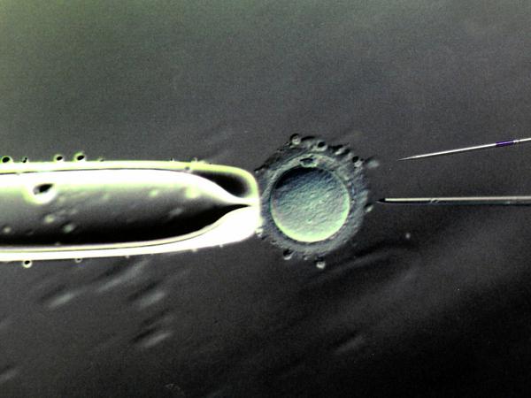 In Laboren lässt sich eine 80- bis 100-fache Vergrößerung der Befruchtung einer Eizelle mit einer Injektionspipette betrachten.