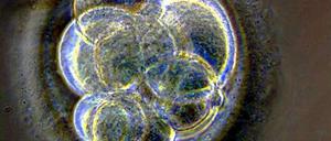 Wenn dem frühen Stadium eines Embryos, der aufgrund eines Gendefekts keine Niere bilden kann, genetisch intakte Stammzellen untergeschoben werden, dann können die Stammzellen dieses Organ bilden. So könnten in Tieren Organe aus menschlichen Zellen gezüchtet werden.