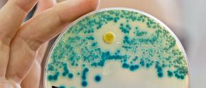 Kultur mit resistenten Bakterien