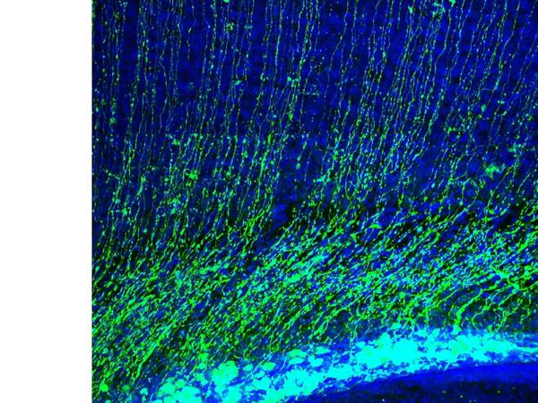 Unterschätzt. Radiale Gliazellen haben Stammzell-Eigenschaften. Sie können zu Nervenzellen werden.