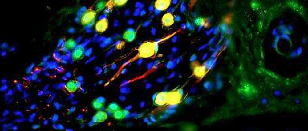 Experimentell. Forscher konnten tauben Wüstenrennmäusen mit embryonalen Stammzellen einen Teil ihres Hörsinns zurückgeben. Bis zur Anwendung beim Menschen ist es jedoch noch ein weiter Weg.