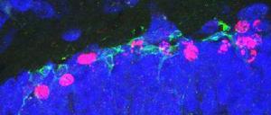 So soll es sein. Kommen genügend Immunzellen im Gehirn an, bilden sich dort auch neue Nervenzellen (rot angefärbt).