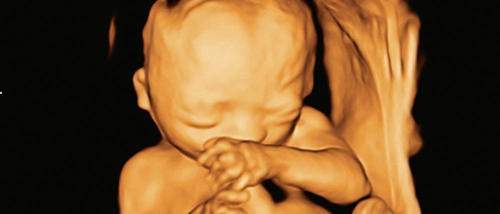 Mit einem 3-D-Ultraschall lassen sich eventuelle Fehlbildungen des Ungeborenen erkennen, die nicht immer eine vermeidbare Ursache haben, sondern mitunter einfach „zufällig“ passieren. 