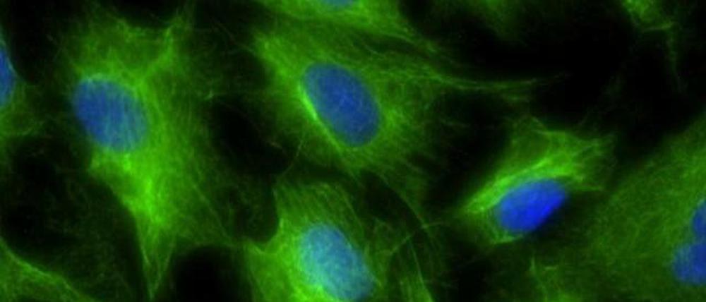 Es werde Thymus. Forscher der Universität Edinburgh haben Bindegewebe in Thymuszellen (grün, mit blau gefärbtem Zellkern) verwandelt, die für ein intaktes Immunsystem nötig sind. 