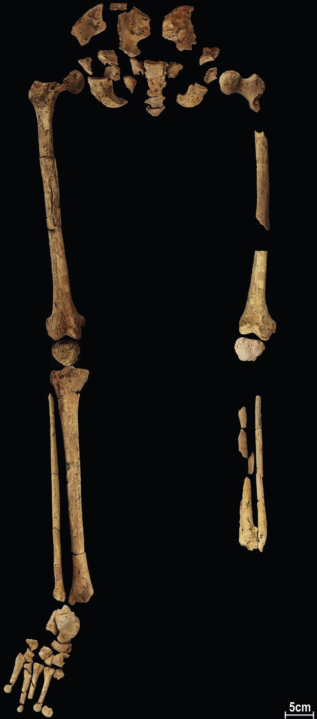 Vom unteren Teil des Skeletts fehlen die Knochen des linken Fußes und Teile von Schien- und Wadenbein.