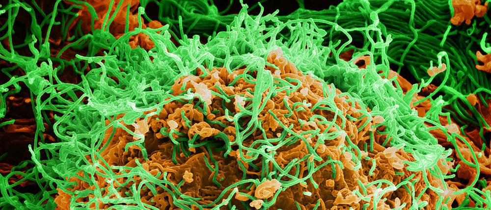 Angefärbte elektronenmikroskopische Aufnahme von Ebola-Virenkörpern, die sich von einer befallenen Zelle lösen.